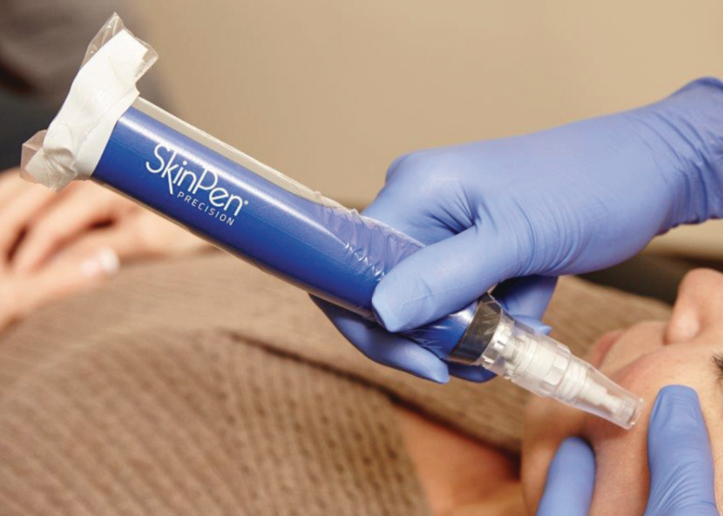 Gloved practitioner uses a blue SkinPen Precision device on a client’s cheek for microneedling treatment