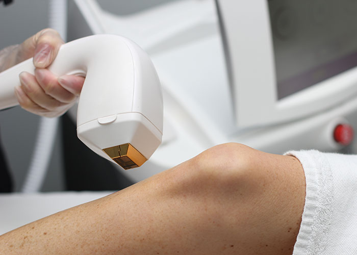 Handheld cosmetic laser device pressed against a patient’s leg during a treatment session by a clinician.