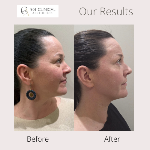 Results template - Website
